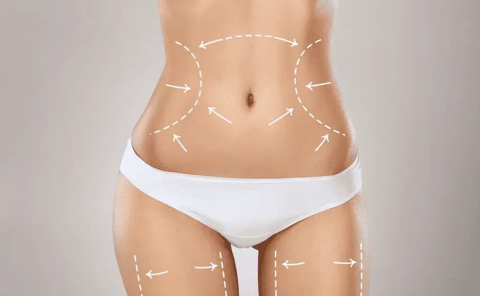 Türkiye'de Liposuction Güvenli mi? Her Hastanın Bilmesi Gerekenler